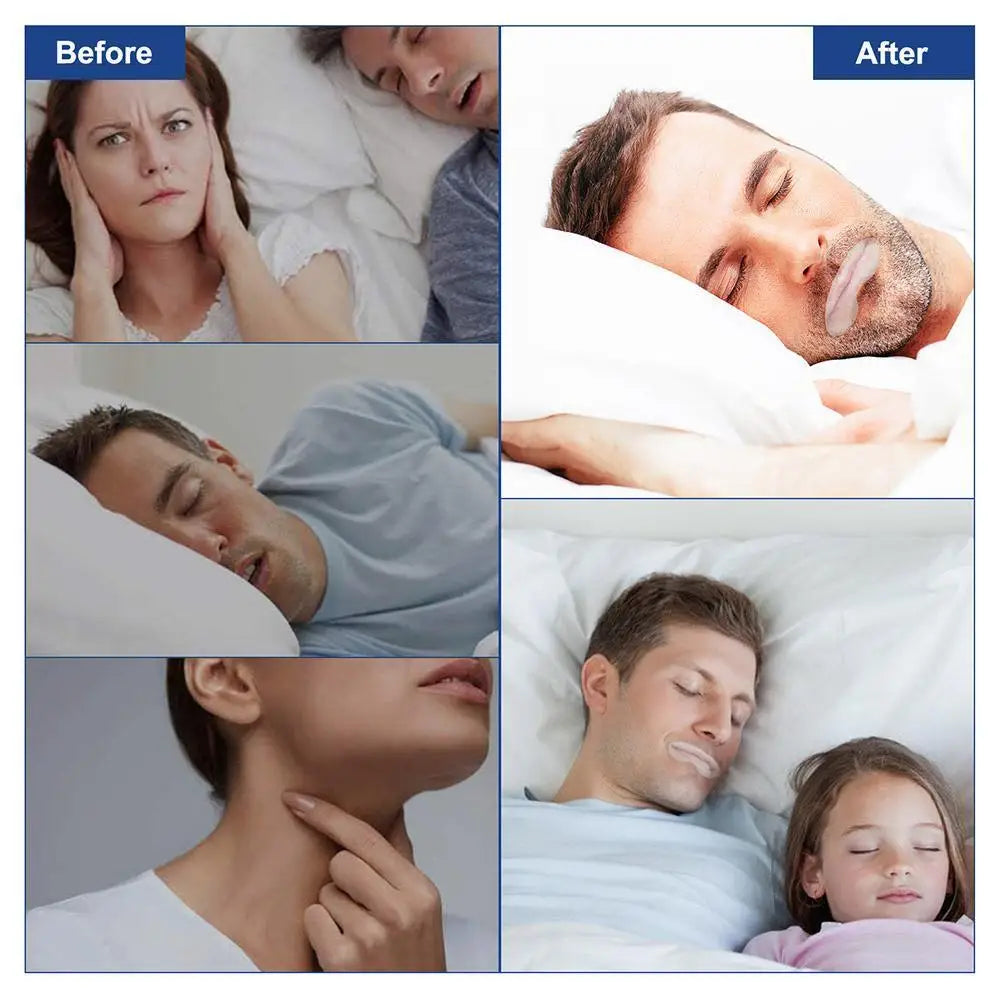 90Pcs Mouth Tape Sleep Strip for Anti-Snoring Mouth Breathing Tape to Improve Sleep Mouth Stickers for Snoring Lip Patch